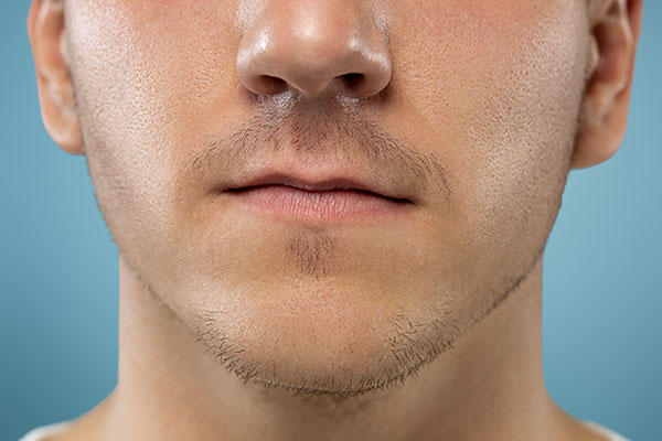 Adult Cleft Lip & Palate Surgery